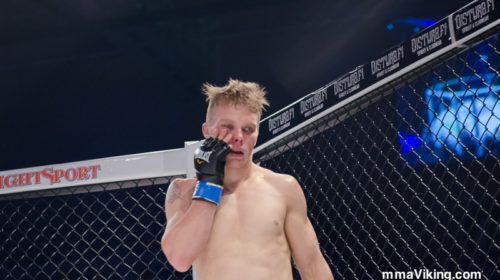 Mikael Nyyssönen checks the damage on his face