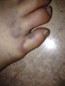 Thoresen's Foot (pictured on Facebook today)