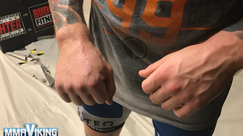 Andreas-Stahl-Broken-Hand